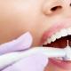 Советы стоматолога: что такое качественно сделанная пломба?